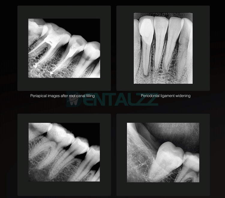 Runyes DR730 Dental cyfrowy czujnik rentgenowski wewnątrzustny system obrazu z czujnikiem